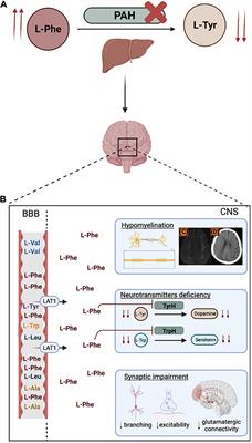 Engineering Organoids for in vitro Modeling of Phenylketonuria